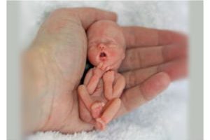 Catholic Medical Association Applauds HHS’s First Step Cancelling Contract for Medical Research Using Aborted Babies, However, Nearly $100 Million For Similar Experiments Remain