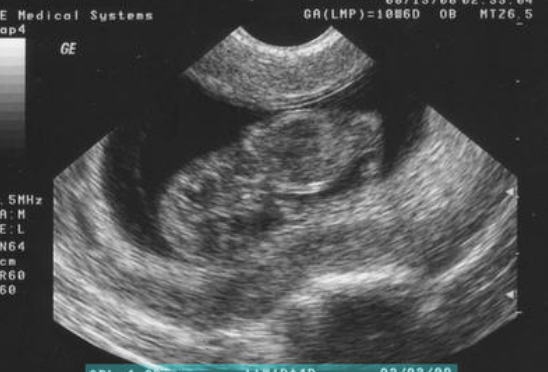 Yes, abortion (killing innocent, defenseless life) matters... even in the voting booth!